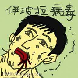 伊波拉病毒 ebola virus