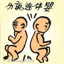 分离连体婴 separates conjoined twins