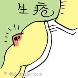生疮 生疮 soars or wound on arm