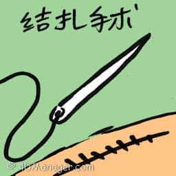 结扎手术 结扎手术 ligation
